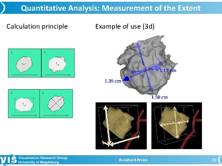 Quantitative Analysis: Measurement of the Extent Calculation principle Example of use (3 d) Bernhard