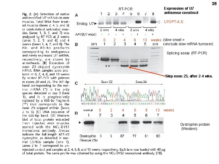 35 Expression of U 7 antisense construct RT-PCR U 7 OPT-A. S. Endog. U