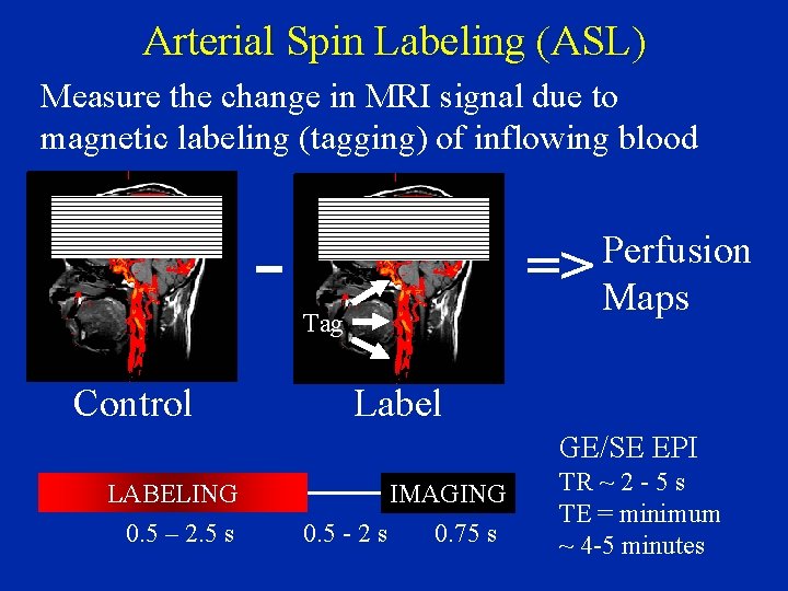 Arterial Spin Labeling (ASL) Measure the change in MRI signal due to magnetic labeling
