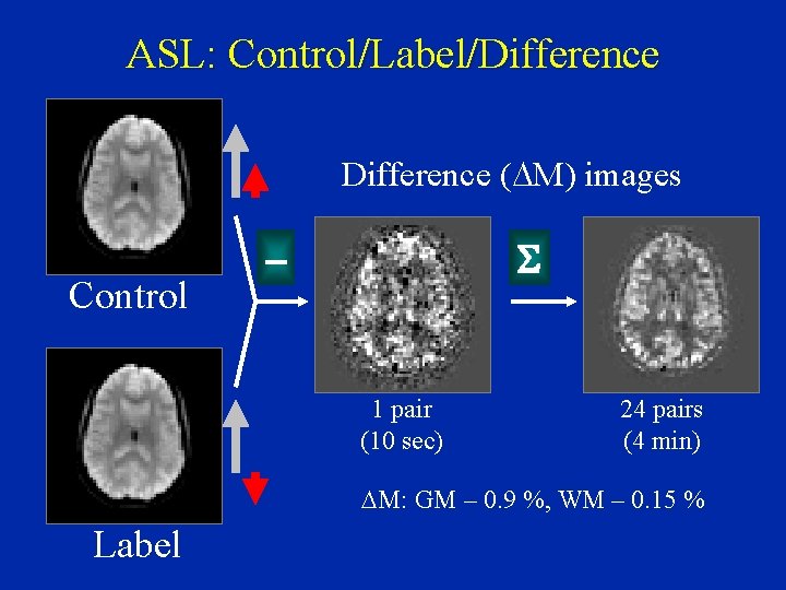 ASL: Control/Label/Difference (DM) images Control - S 1 pair (10 sec) 24 pairs (4