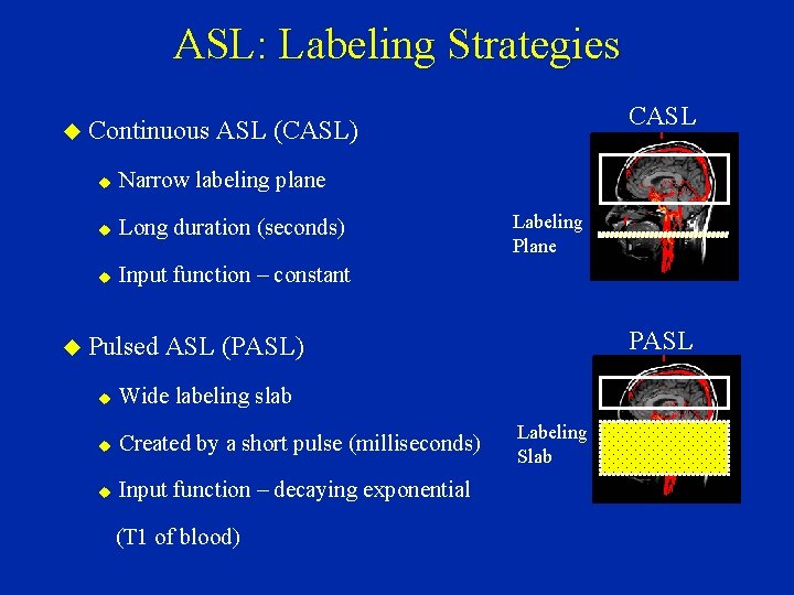 ASL: Labeling Strategies CASL Continuous ASL (CASL) Narrow labeling plane Long duration (seconds) Input