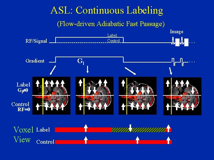 ASL: Continuous Labeling (Flow-driven Adiabatic Fast Passage) Label Control RF/Signal Gradient Label Gl¹ 0