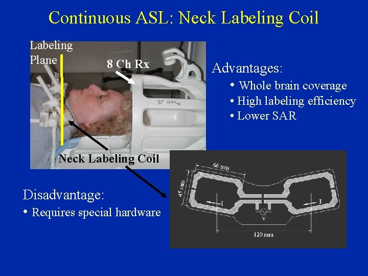 Continuous ASL: Neck Labeling Coil Labeling Plane 8 Ch Rx Advantages: • Whole brain