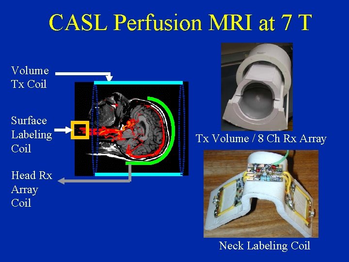 CASL Perfusion MRI at 7 T Volume Tx Coil Surface Labeling Coil Tx Volume