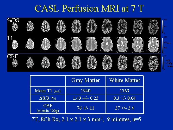 CASL Perfusion MRI at 7 T %DS T 1 ms CBF ml/ (100 g.