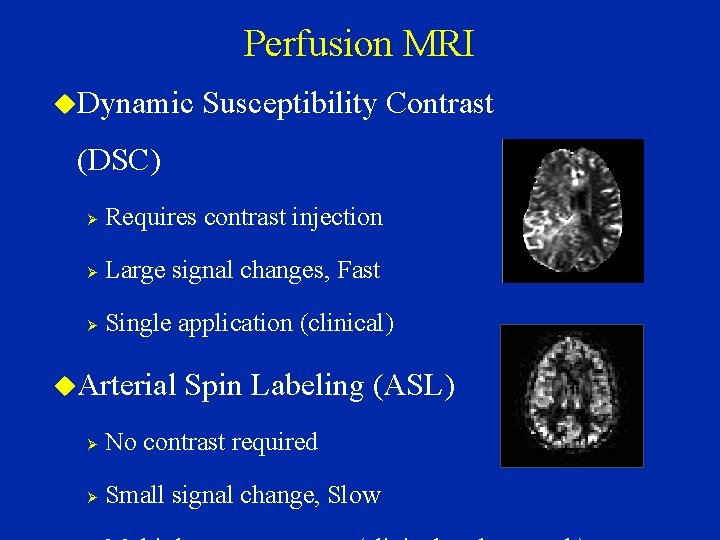 Perfusion MRI Dynamic Susceptibility Contrast (DSC) Ø Requires contrast injection Ø Large signal changes,