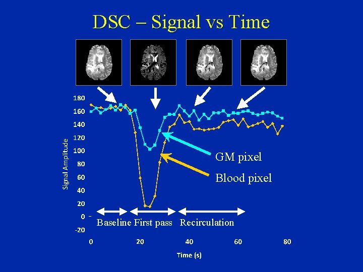 DSC – Signal vs Time GM pixel Blood pixel Baseline First pass Recirculation 