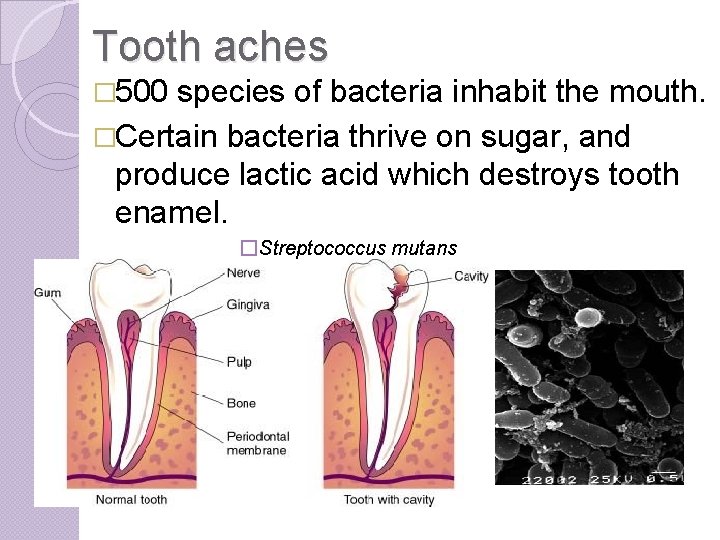 Tooth aches � 500 species of bacteria inhabit the mouth. �Certain bacteria thrive on