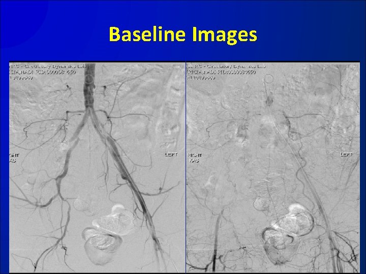 Baseline Images 