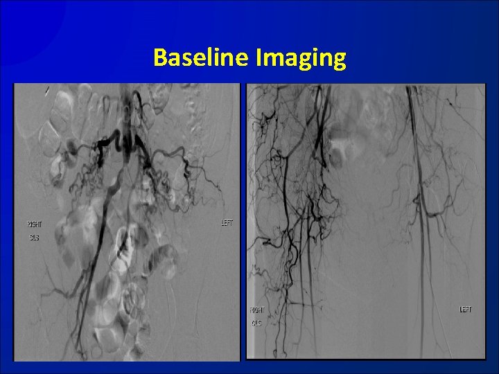 Baseline Imaging 