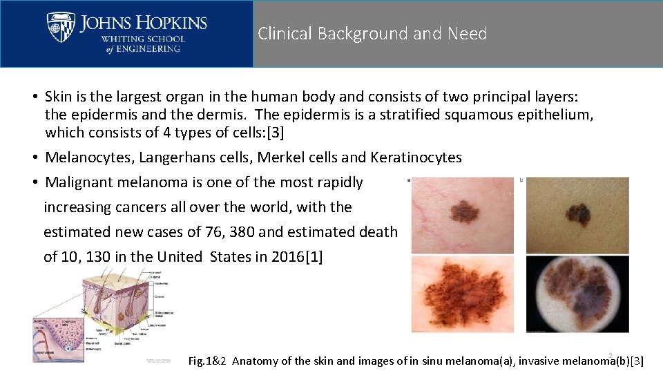 Clinical Background and Need • Skin is the largest organ in the human body Clinical Background and Need • Skin is the largest organ in the human body