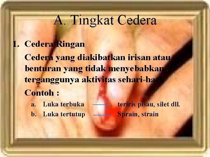 A. Tingkat Cedera 1. Cedera Ringan Cedera yang diakibatkan irisan atau benturan yang tidak