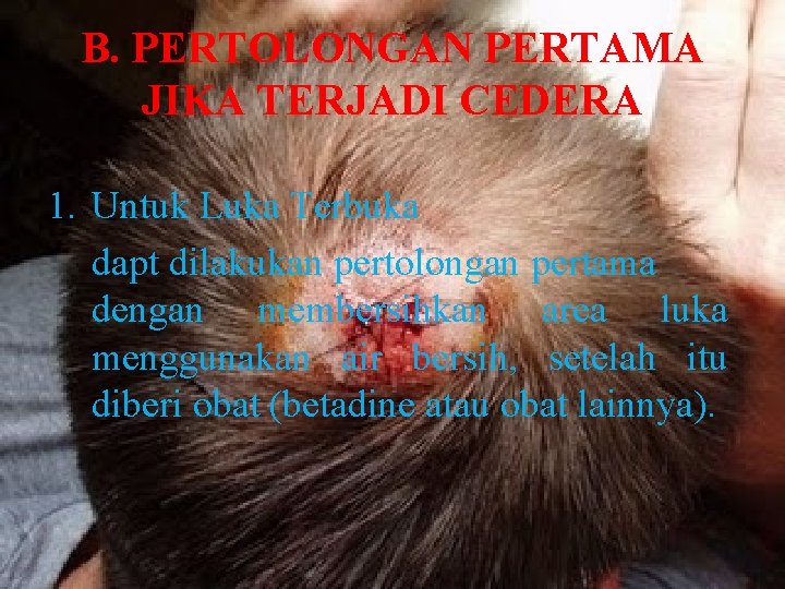 B. PERTOLONGAN PERTAMA JIKA TERJADI CEDERA 1. Untuk Luka Terbuka dapt dilakukan pertolongan pertama