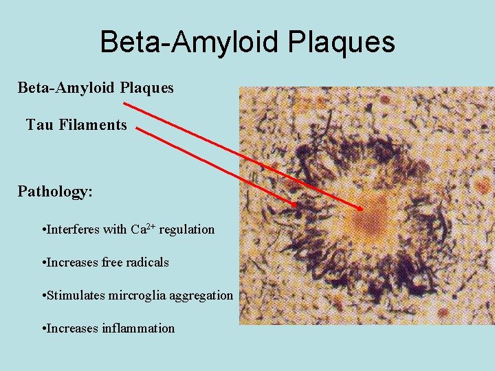 Beta-Amyloid Plaques Tau Filaments Pathology: • Interferes with Ca 2+ regulation • Increases free