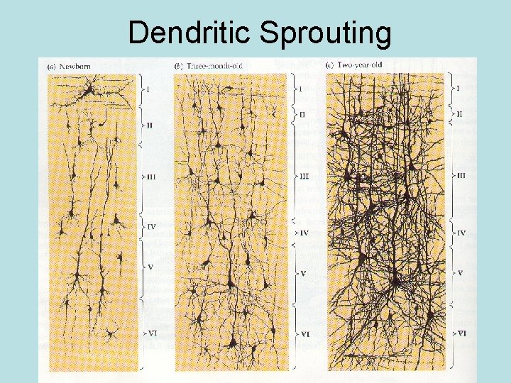 Dendritic Sprouting 