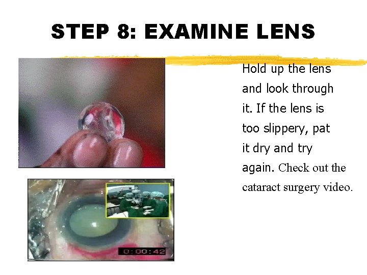 STEP 8: EXAMINE LENS Hold up the lens and look through it. If the