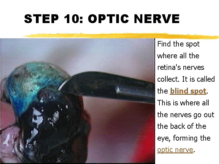 STEP 10: OPTIC NERVE Find the spot where all the retina's nerves collect. It