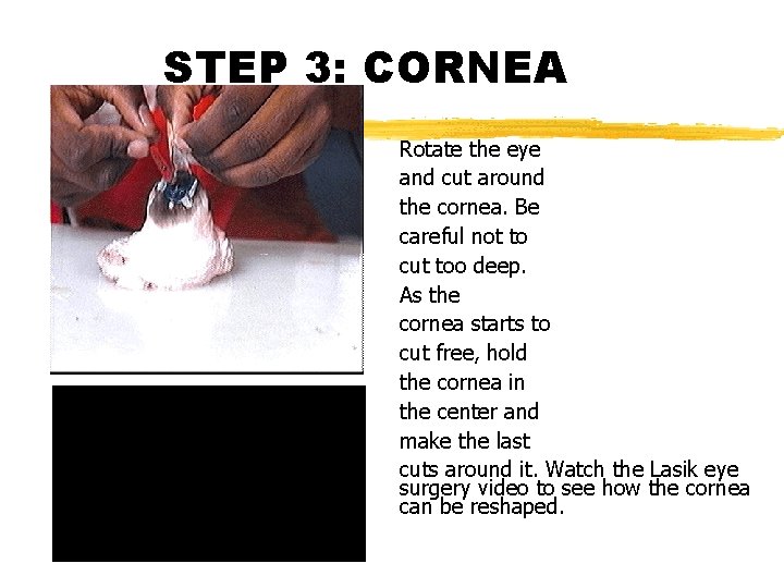 STEP 3: CORNEA Rotate the eye and cut around the cornea. Be careful not
