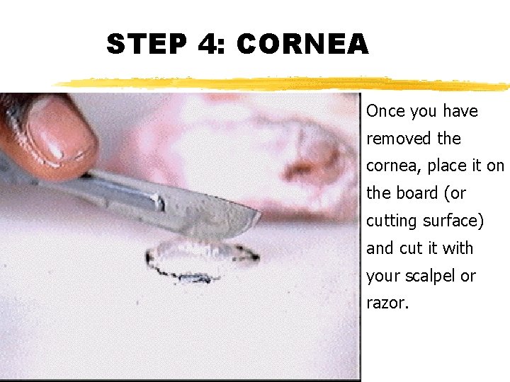 STEP 4: CORNEA Once you have removed the cornea, place it on the board