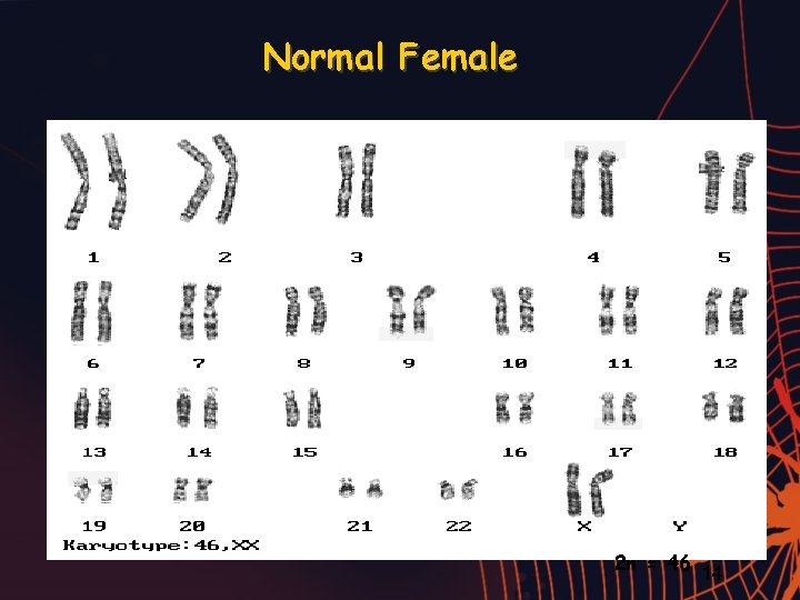 Normal Female 2 n = 46 14 