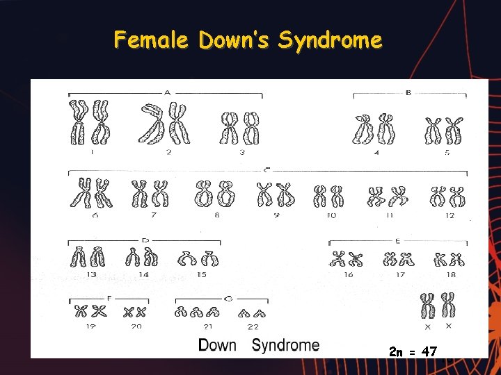 Female Down’s Syndrome 2 n = 47 16 