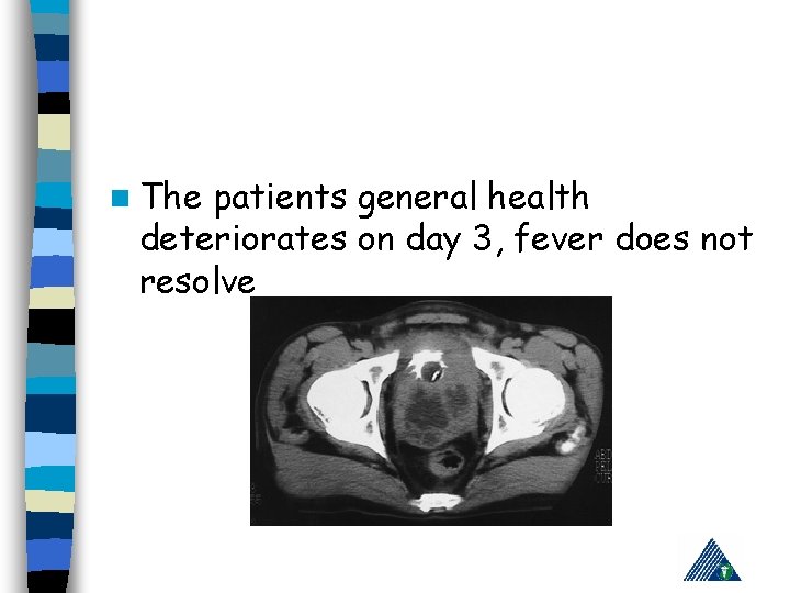 n The patients general health deteriorates on day 3, fever does not resolve 