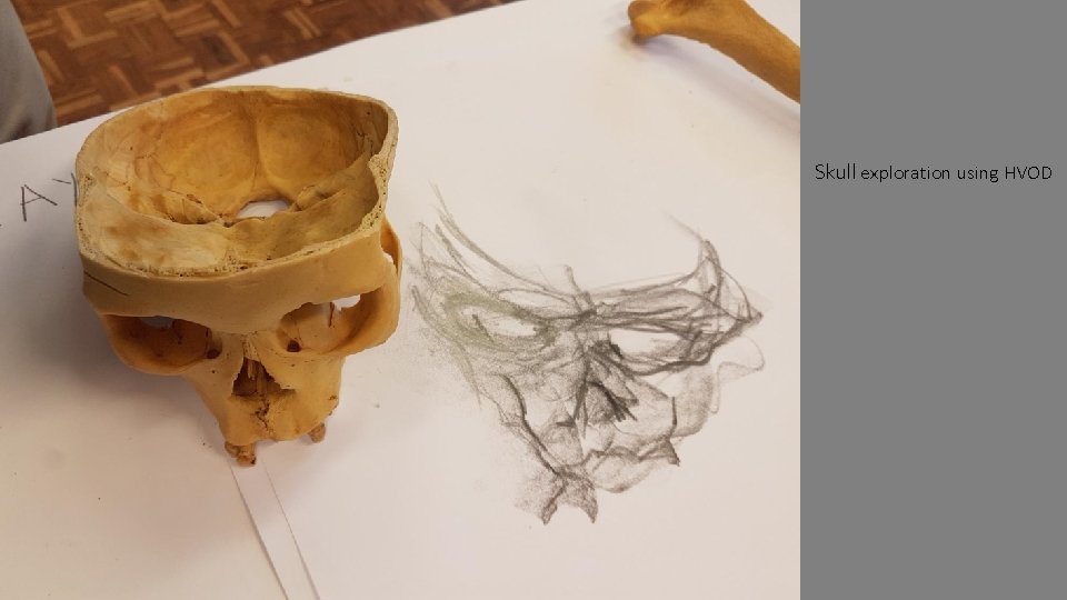 Skull exploration using HVOD 