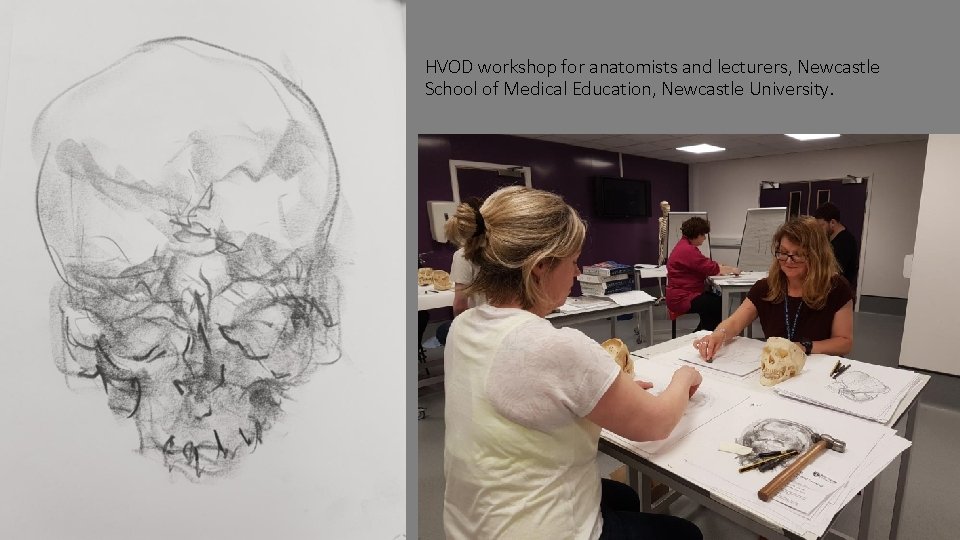 HVOD workshop for anatomists and lecturers, Newcastle School of Medical Education, Newcastle University. 