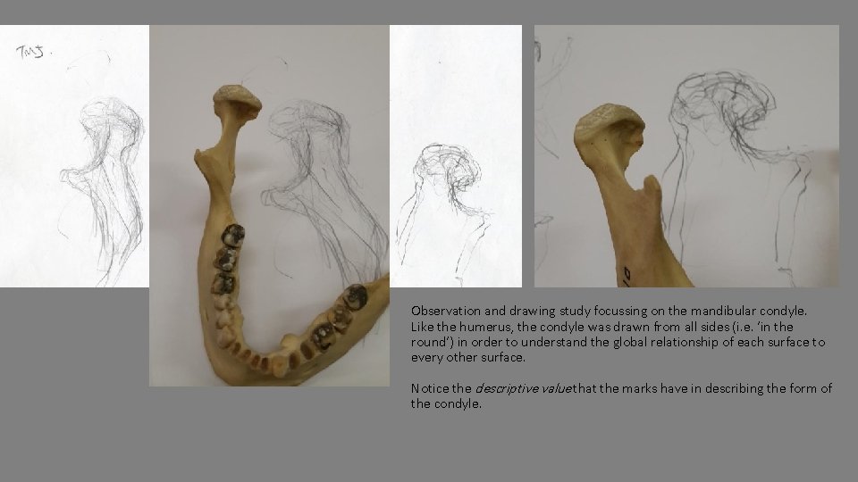 Observation and drawing study focussing on the mandibular condyle. Like the humerus, the condyle