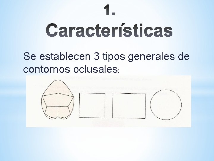Se establecen 3 tipos generales de contornos oclusales: 
