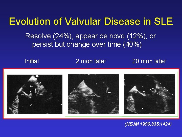 Evolution of Valvular Disease in SLE Resolve (24%), appear de novo (12%), or persist Evolution of Valvular Disease in SLE Resolve (24%), appear de novo (12%), or persist