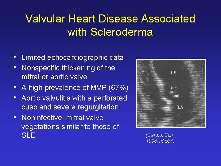 Valvular Heart Disease Associated with Scleroderma • • • Limited echocardiographic data Nonspecific thickening Valvular Heart Disease Associated with Scleroderma • • • Limited echocardiographic data Nonspecific thickening
