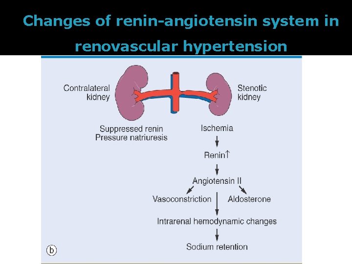 Changes of renin-angiotensin system in renovascular hypertension 