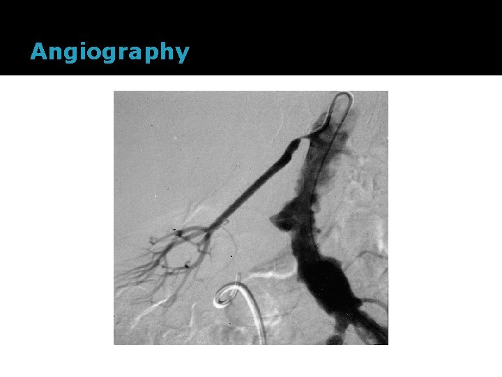 Angiography 