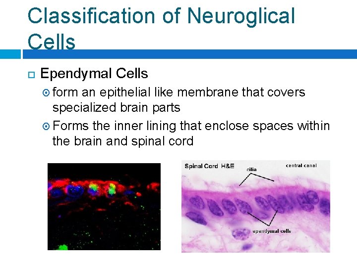 Classification of Neuroglical Cells Ependymal Cells form an epithelial like membrane that covers specialized