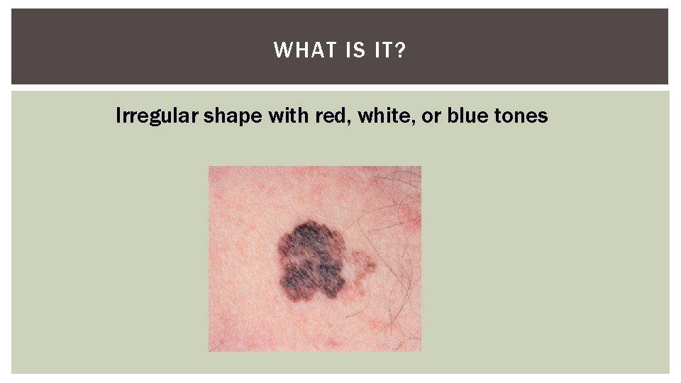 WHAT IS IT? Irregular shape with red, white, or blue tones 