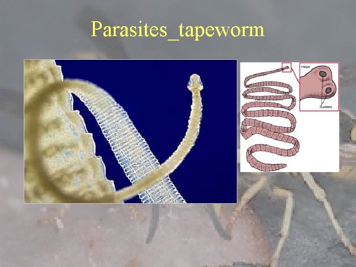 Parasites_tapeworm 