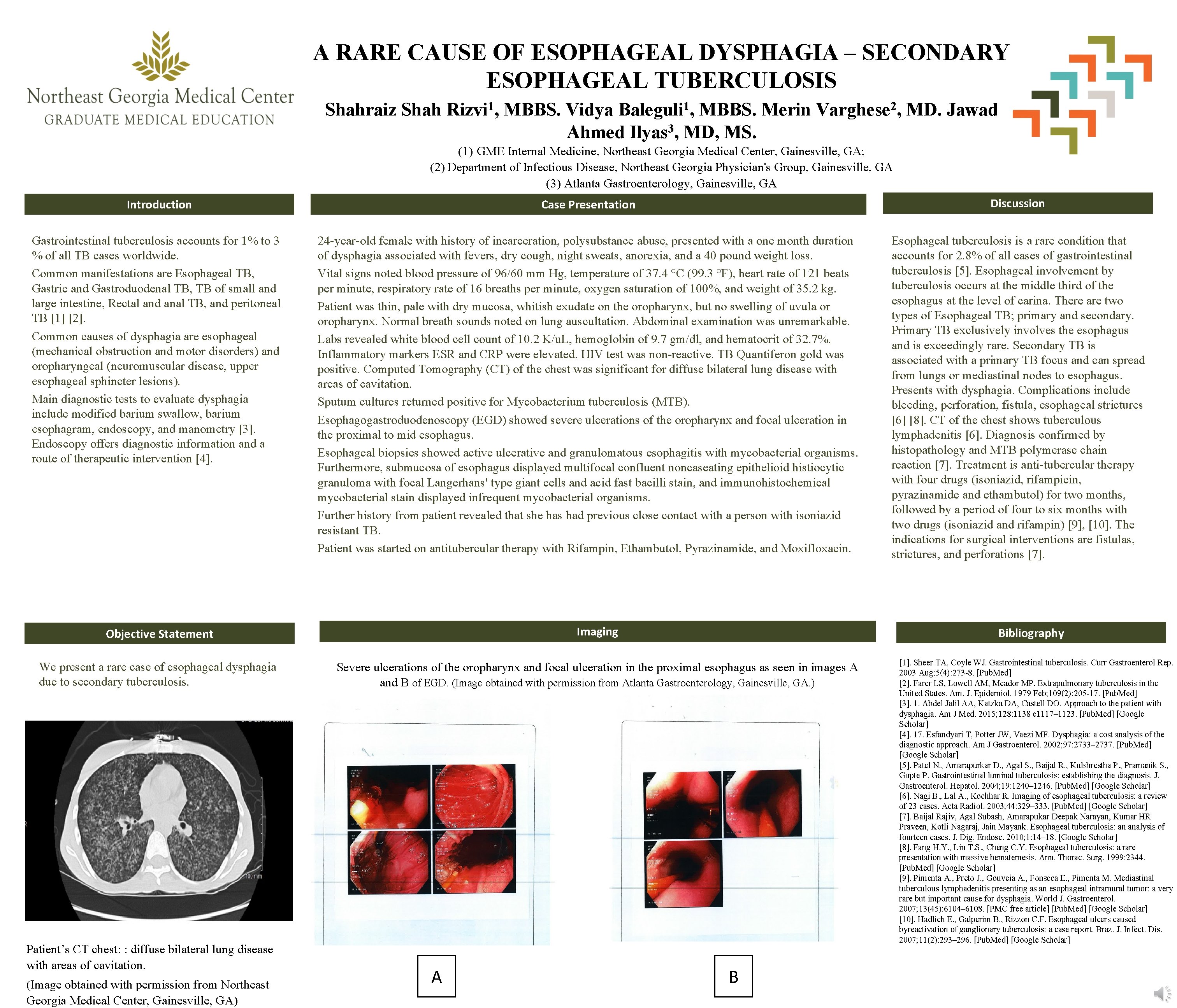 A RARE CAUSE OF ESOPHAGEAL DYSPHAGIA – SECONDARY ESOPHAGEAL TUBERCULOSIS Shahraiz Shah 1 Rizvi