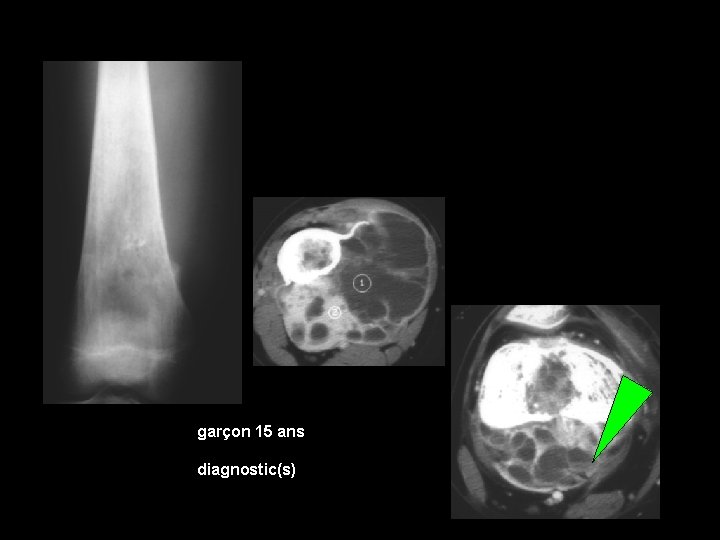 garçon 15 ans diagnostic(s) 