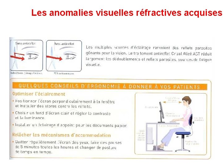 Les anomalies visuelles réfractives acquises Les anomalies visuelles réfractives acquises