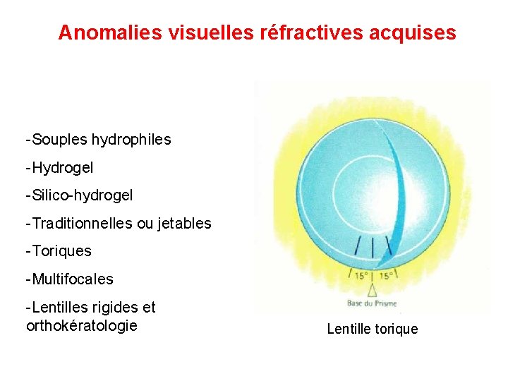 Anomalies visuelles réfractives acquises -Souples hydrophiles -Hydrogel -Silico-hydrogel -Traditionnelles ou jetables -Toriques -Multifocales -Lentilles