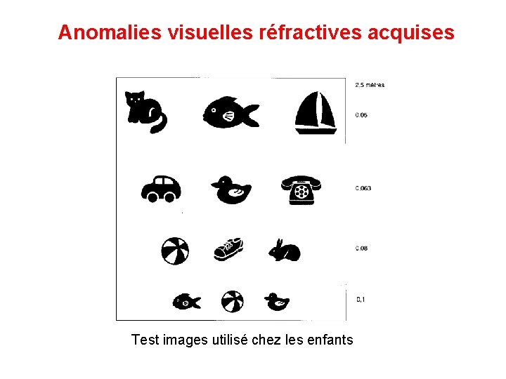 Anomalies visuelles réfractives acquises Test images utilisé chez les enfants 