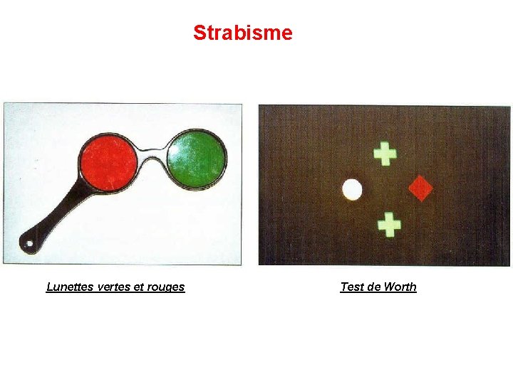 Strabisme Lunettes vertes et rouges Test de Worth 