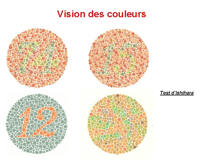 Vision des couleurs Test d’Ishihara 