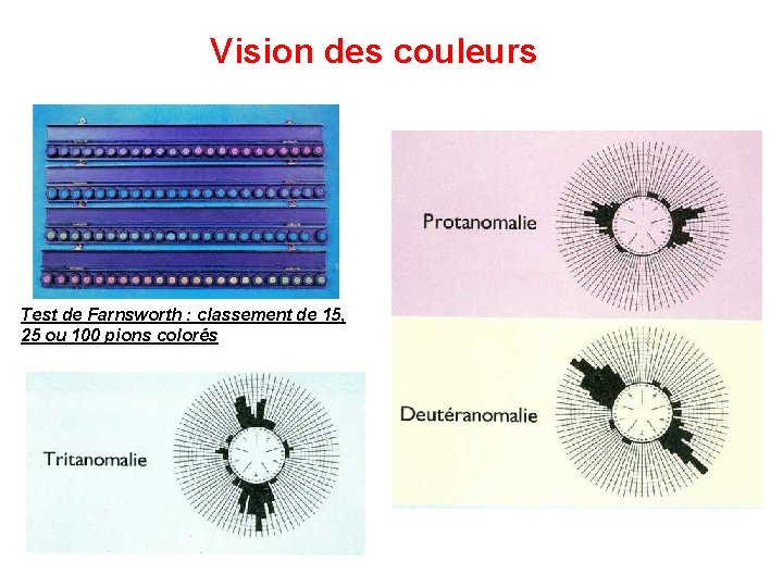 Vision des couleurs Test de Farnsworth : classement de 15, 25 ou 100 pions