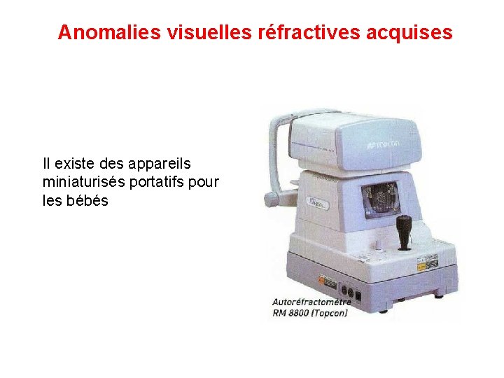 Anomalies visuelles réfractives acquises Il existe des appareils miniaturisés portatifs pour les bébés 