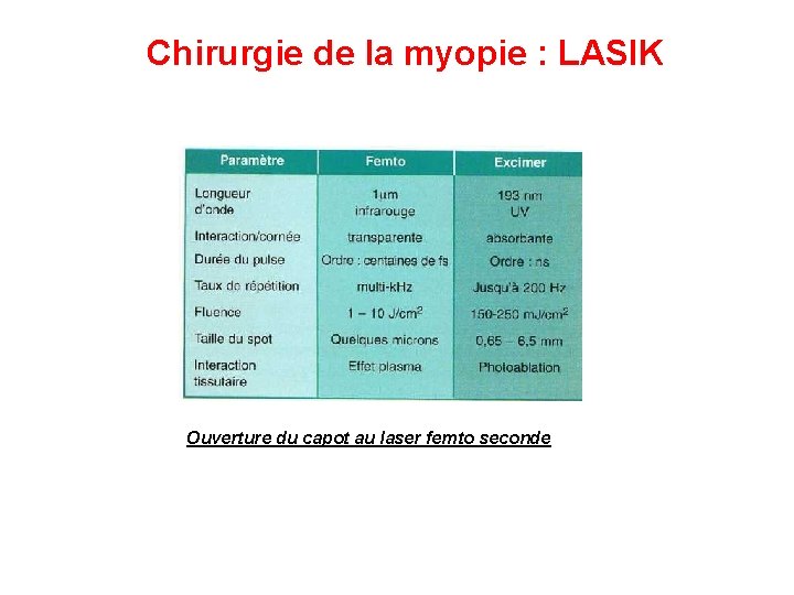 Chirurgie de la myopie : LASIK Ouverture du capot au laser femto seconde 