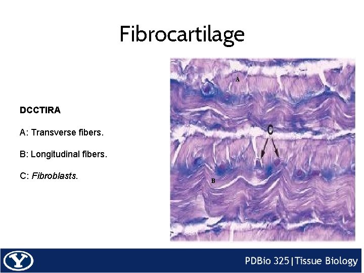 Fibrocartilage A DCCTIRA A: Transverse fibers. B: Longitudinal fibers. C: Fibroblasts. B 