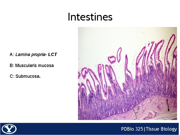 Intestines A: Lamina propria- LCT B: Muscularis mucosa C: Submucosa. A C B 