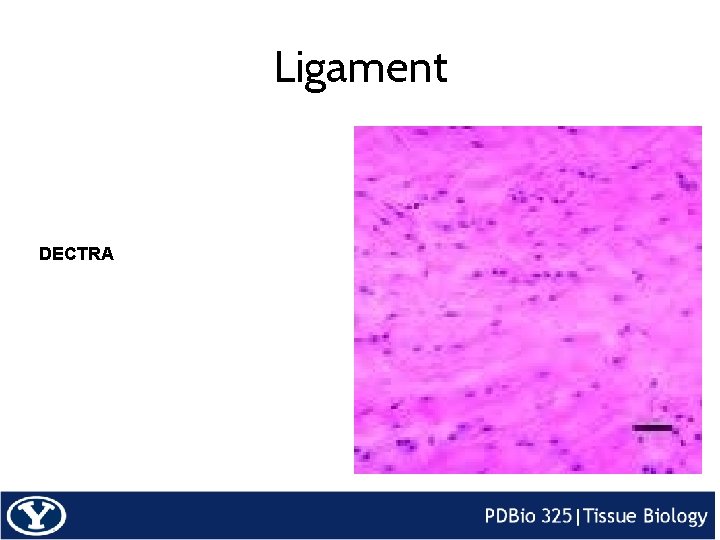 Ligament DECTRA 